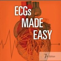 test bank for ecgs made easy 7th edition by barbara j aehlert