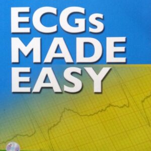 Manual solution For ECGs Made Easy, Fourth Edition (Book & Pocket Reference) 4 by Barbara J Aehlert MSEd BSPA RN