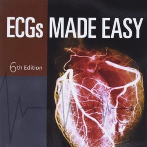 Test Bank For ECGs Made Easy 6th by Barbara J Aehlert MSEd BSPA RN