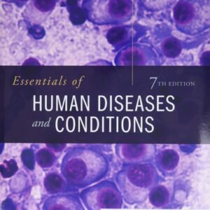 Test Bank For Essentials of Human Diseases and Conditions 7th by Margaret Schell Frazier RN CMA BS, Tracie Fuqua BS CMA (AAMA)